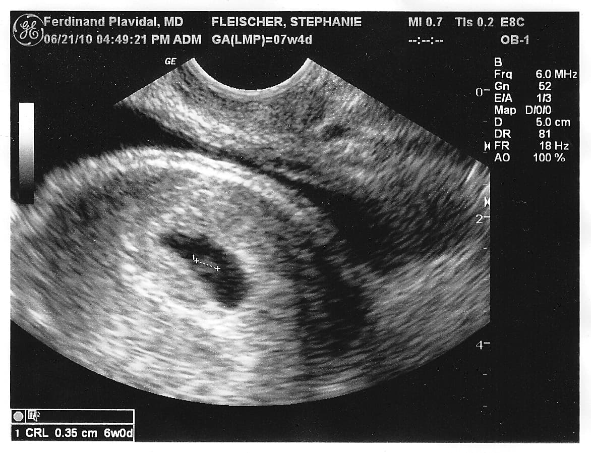 Ultrasound Scan at Klinik Mekar 24 Jam Seri Kembangan